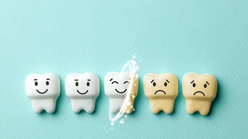10 Cách tẩy trắng răng bị ố vàng nhanh và hiệu quả nhất