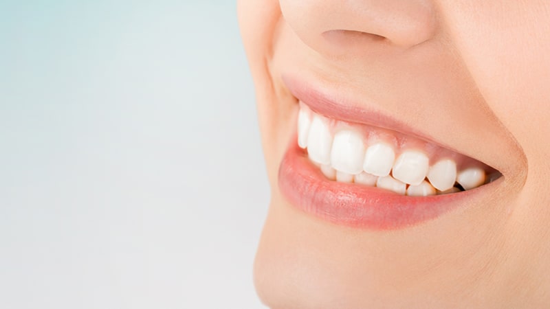 Tẩy trắng răng là gì? Những điều cần biết khi tẩy trắng răng